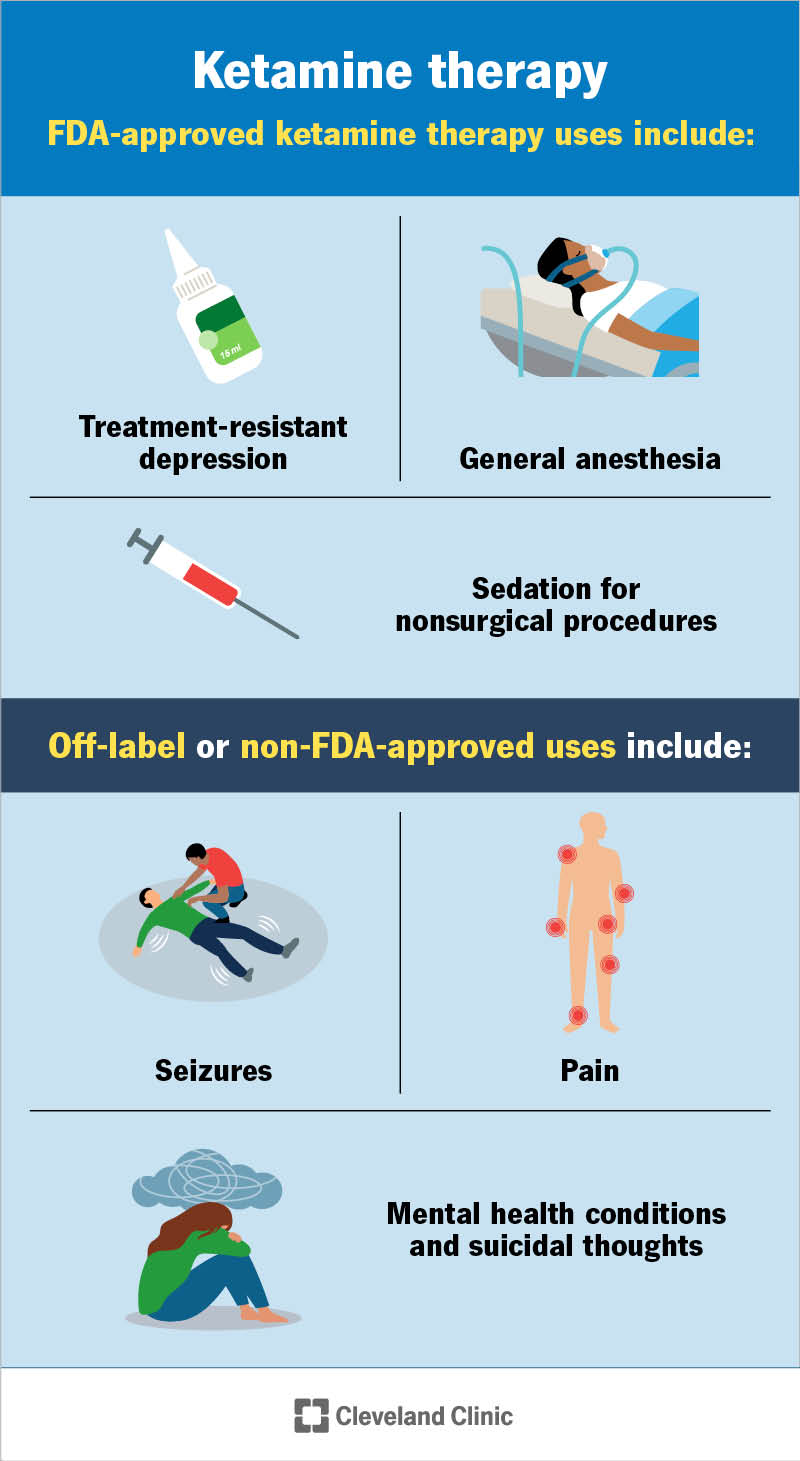Ketamine Therapy