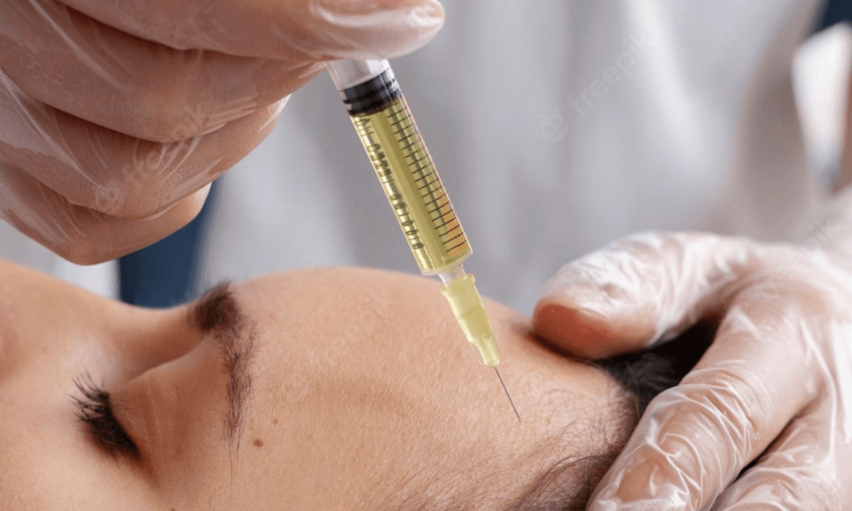 PRP Therapy